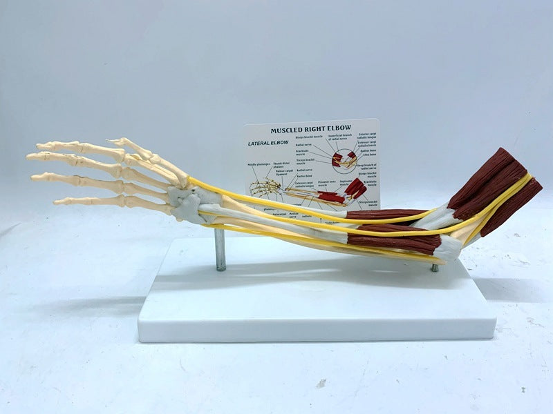 Bändergelenkmodell in Muskelnervenanatomie, menschliches Skelett, Schädel, Arm, Lehrmittel